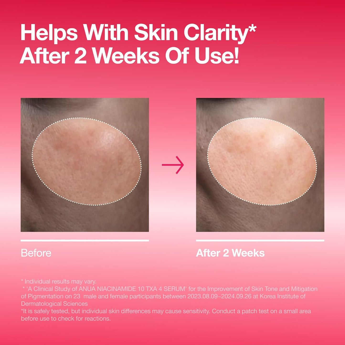Dark Spot Correcting Serum